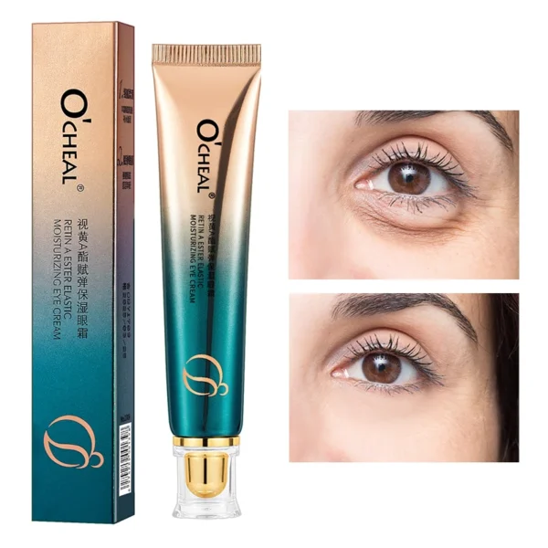 OCHEAL Eye Moisturizing Cream Fades Fine Lines Anti Dark Circles Eye Serum Remove Eye Bag Puffiness Anti-Aging Firmness Eye Care